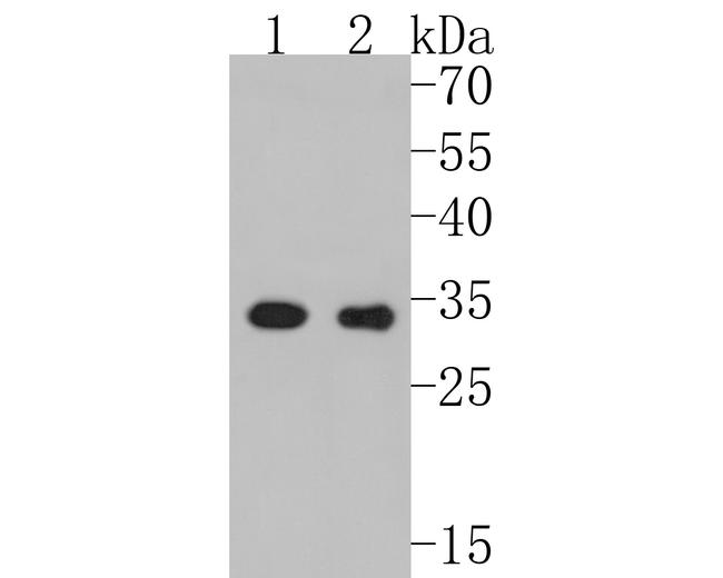 CDK4 Antibody in Western Blot (WB)