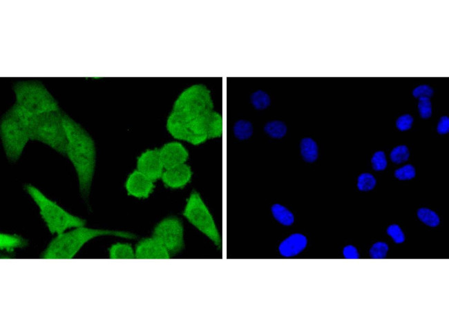 STAT1 Antibody in Immunocytochemistry (ICC/IF)