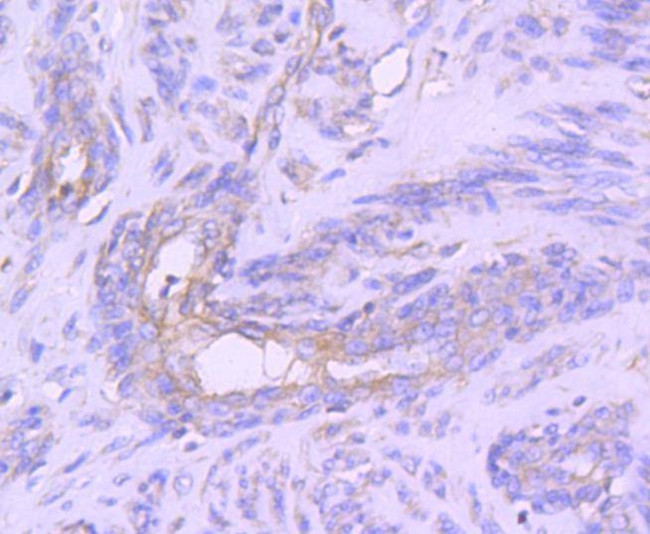 STAT1 Antibody in Immunohistochemistry (Paraffin) (IHC (P))