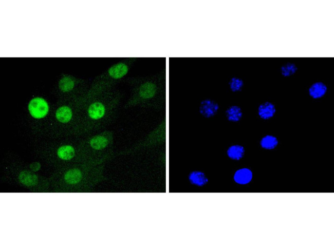 CDK4 Antibody in Immunocytochemistry (ICC/IF)