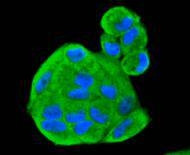 SMAD1 Antibody in Immunocytochemistry (ICC/IF)