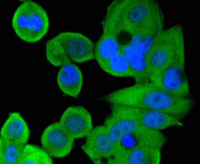 SMAD1 Antibody in Immunocytochemistry (ICC/IF)