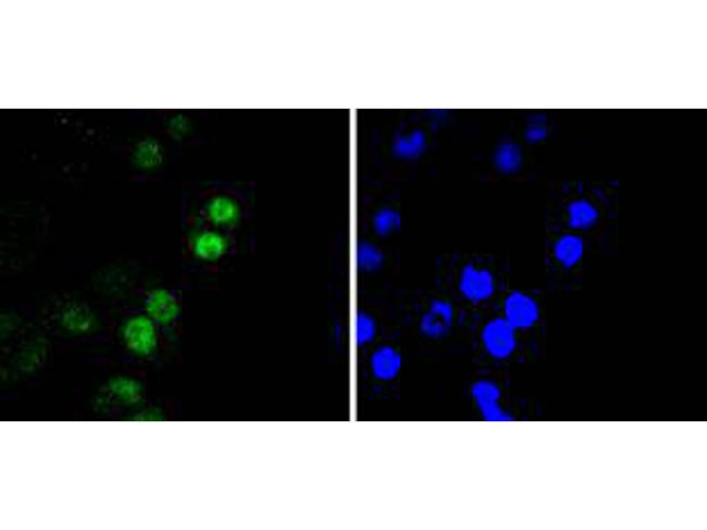 RUNX2 Antibody in Immunocytochemistry (ICC/IF)