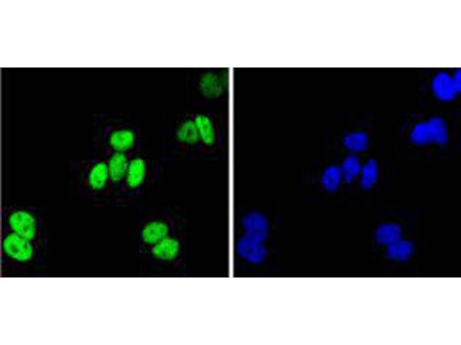 JunB Antibody in Immunocytochemistry (ICC/IF)