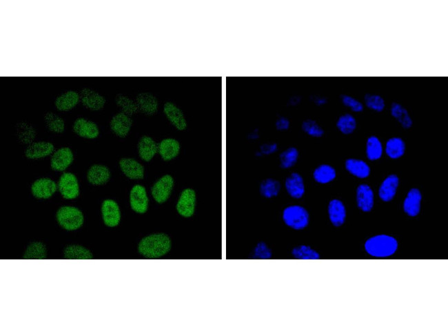 JunB Antibody in Immunocytochemistry (ICC/IF)