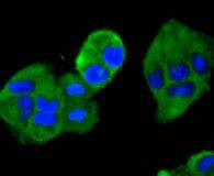 MEK2 Antibody in Immunocytochemistry (ICC/IF)