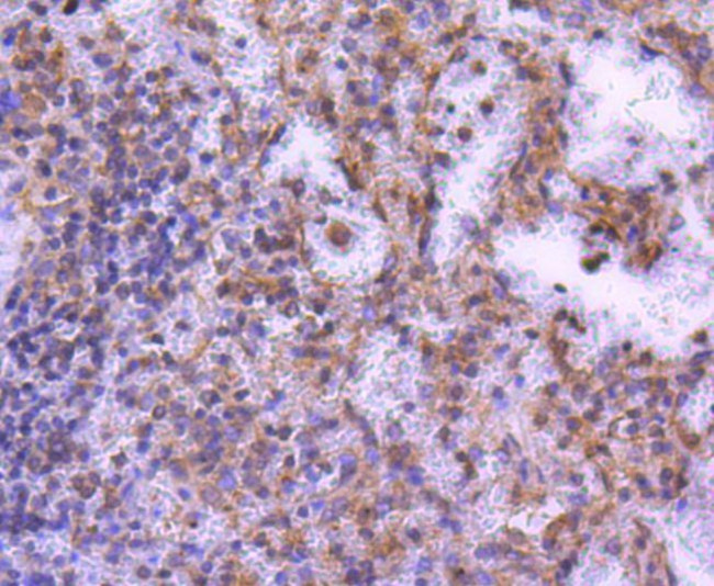 MEK2 Antibody in Immunohistochemistry (Paraffin) (IHC (P))