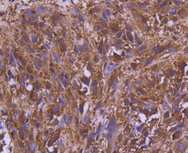 MEK2 Antibody in Immunohistochemistry (Paraffin) (IHC (P))