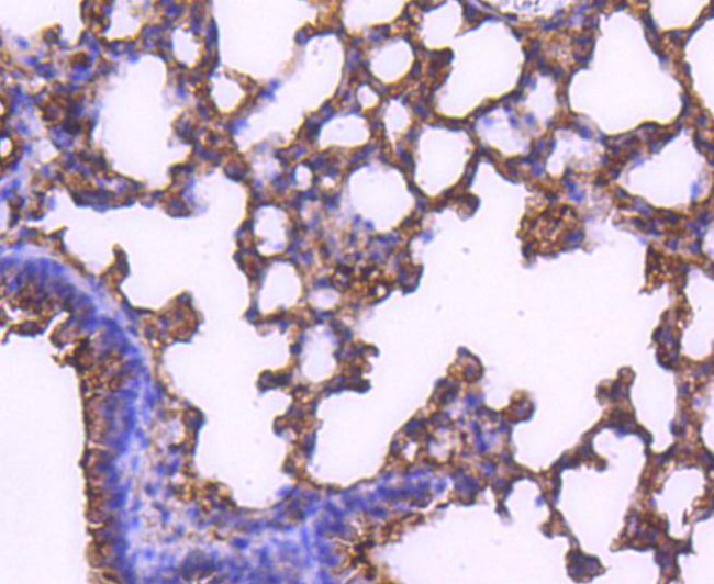 MEK2 Antibody in Immunohistochemistry (Paraffin) (IHC (P))