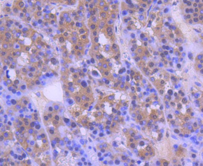 MEK2 Antibody in Immunohistochemistry (Paraffin) (IHC (P))