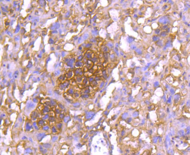 14-3-3 epsilon Antibody in Immunohistochemistry (Paraffin) (IHC (P))