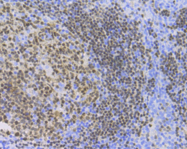 PAX5 Antibody in Immunohistochemistry (Paraffin) (IHC (P))