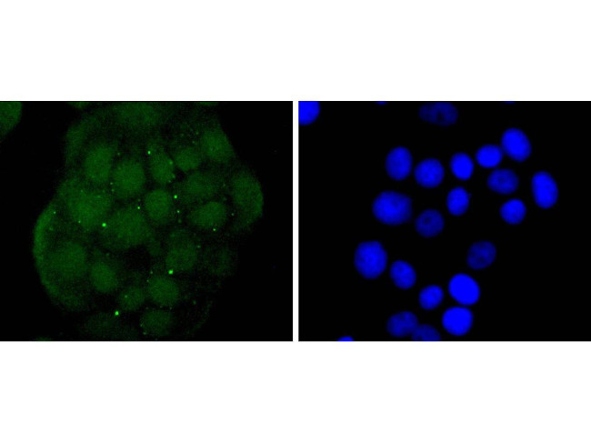 EZH2 Antibody in Immunocytochemistry (ICC/IF)