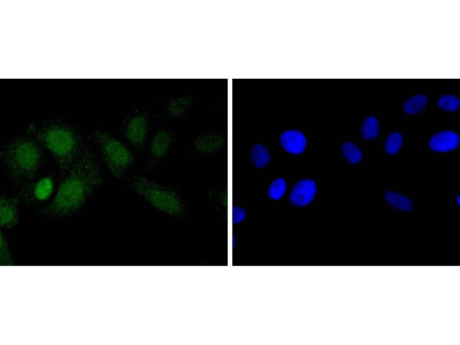 EZH2 Antibody in Immunocytochemistry (ICC/IF)