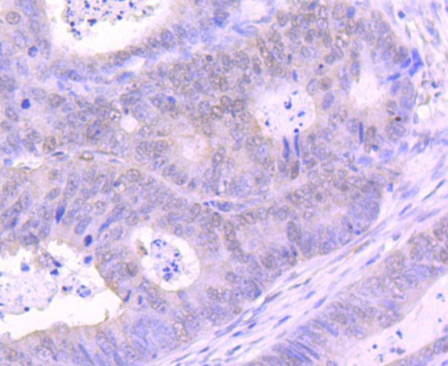 EZH2 Antibody in Immunohistochemistry (Paraffin) (IHC (P))