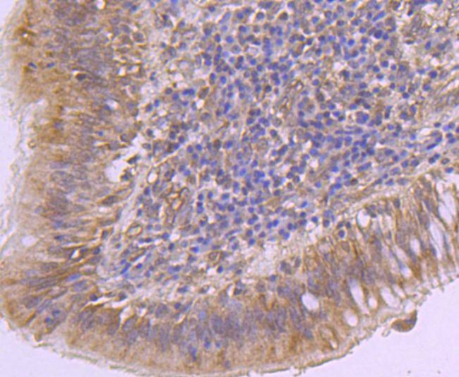 EZH2 Antibody in Immunohistochemistry (Paraffin) (IHC (P))