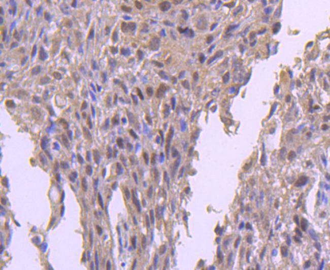 EZH2 Antibody in Immunohistochemistry (Paraffin) (IHC (P))