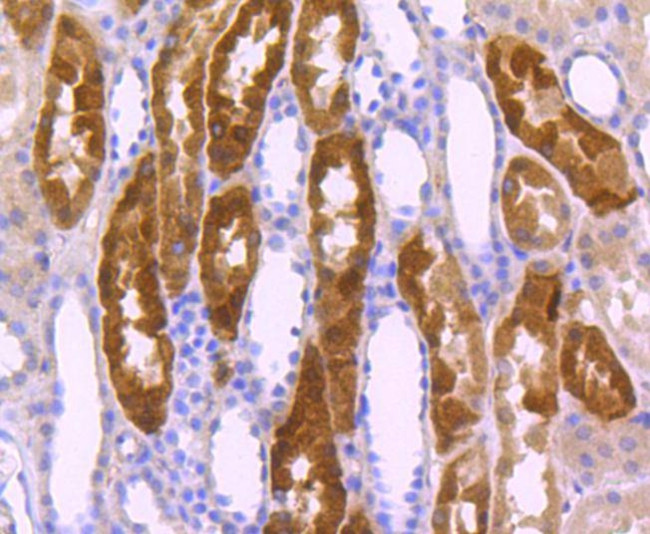 ITGA5 Antibody in Immunohistochemistry (Paraffin) (IHC (P))