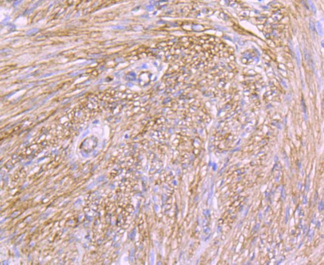 ITGA5 Antibody in Immunohistochemistry (Paraffin) (IHC (P))