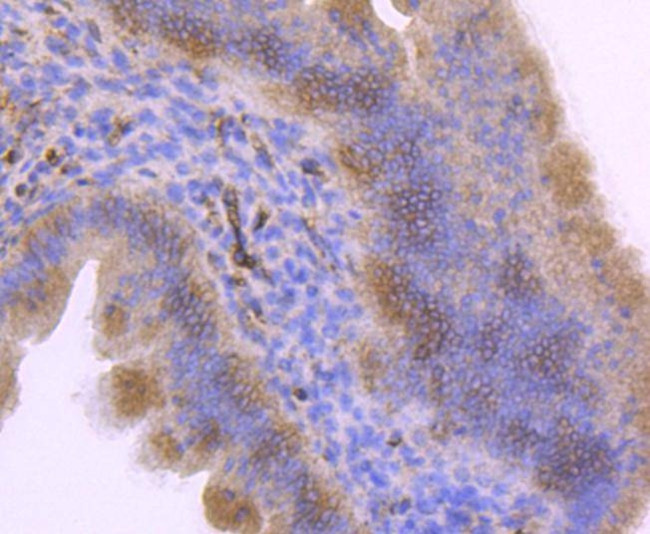 ITGA5 Antibody in Immunohistochemistry (Paraffin) (IHC (P))