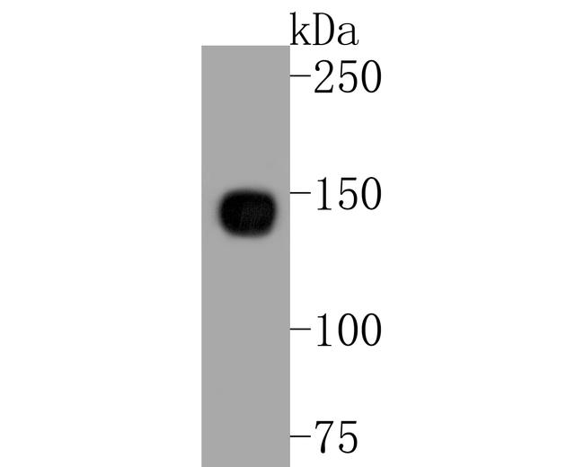 ITGA5 Antibody in Western Blot (WB)