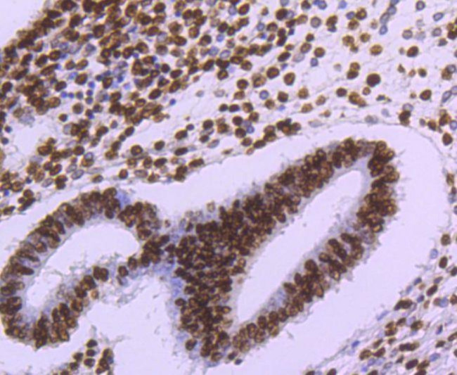 Histone H3 Antibody in Immunohistochemistry (Paraffin) (IHC (P))