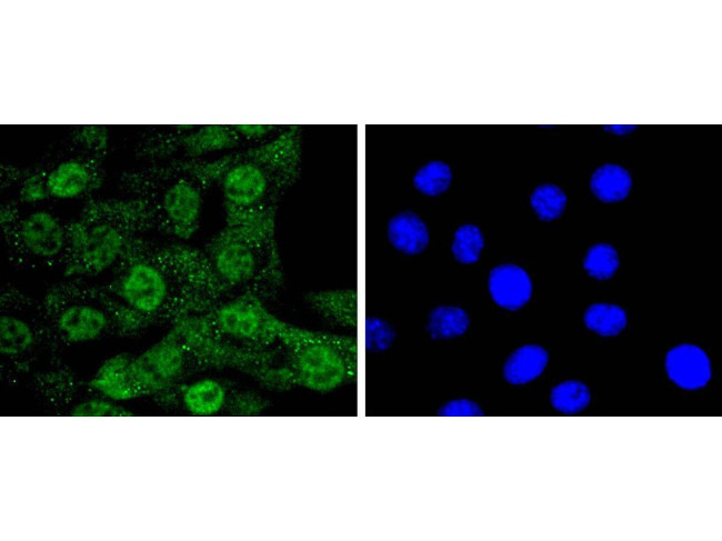 Cdc5L Antibody in Immunocytochemistry (ICC/IF)