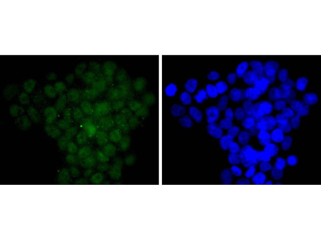 Cdc5L Antibody in Immunocytochemistry (ICC/IF)