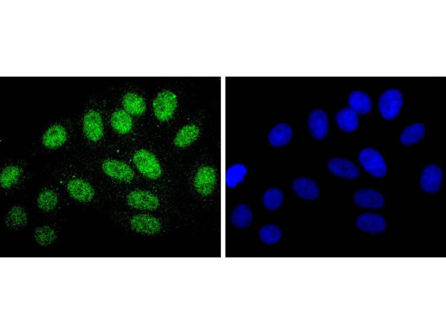 Cdc5L Antibody in Immunocytochemistry (ICC/IF)