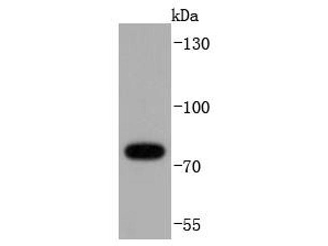 RIP1 Antibody in Western Blot (WB)