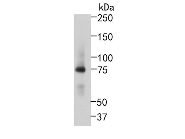 RIP1 Antibody in Western Blot (WB)