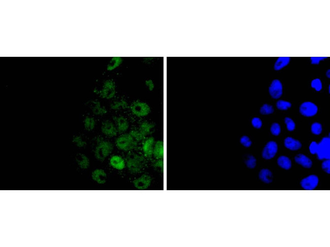 Histone H3 Antibody in Immunocytochemistry (ICC/IF)