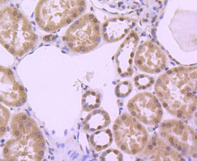 Histone H3 Antibody in Immunohistochemistry (Paraffin) (IHC (P))