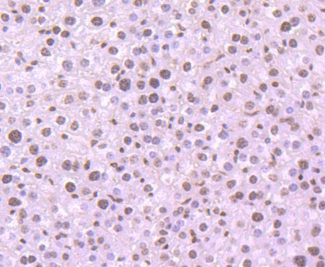 Histone H3 Antibody in Immunohistochemistry (Paraffin) (IHC (P))