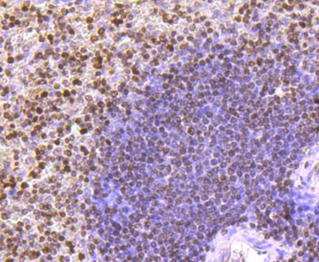 Histone H3 Antibody in Immunohistochemistry (Paraffin) (IHC (P))