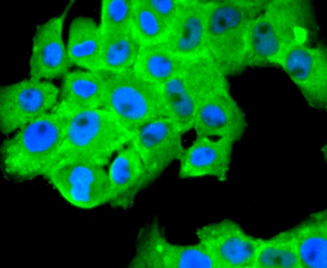 FASN Antibody in Immunocytochemistry (ICC/IF)