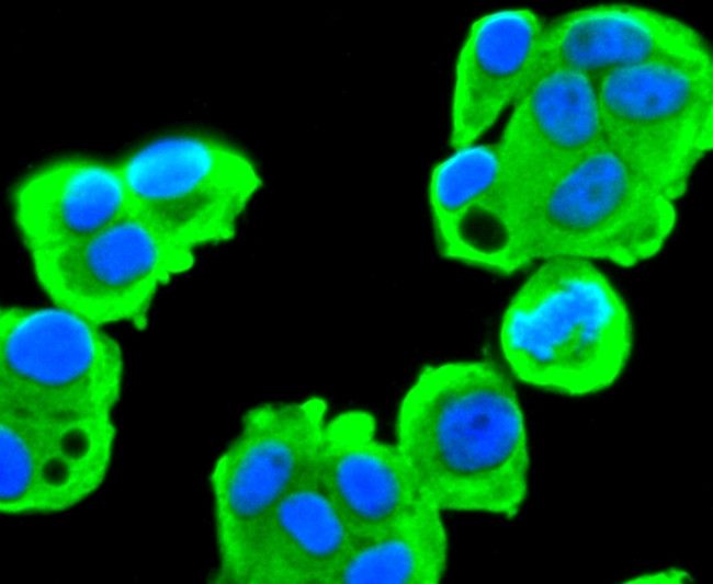 FASN Antibody in Immunocytochemistry (ICC/IF)