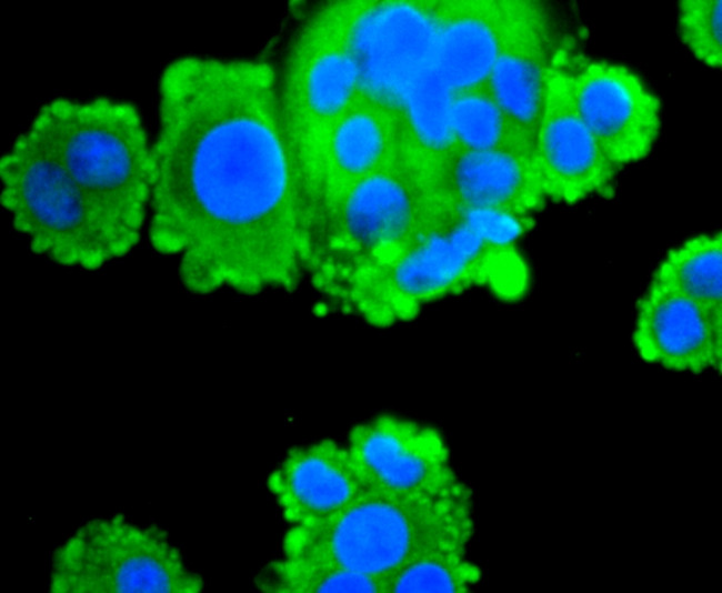 FASN Antibody in Immunocytochemistry (ICC/IF)