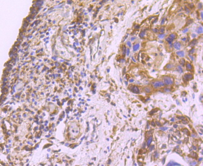 FASN Antibody in Immunohistochemistry (Paraffin) (IHC (P))