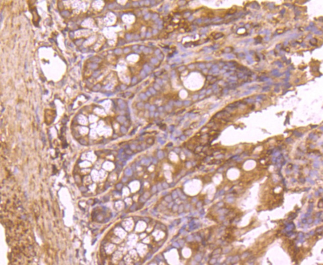 FASN Antibody in Immunohistochemistry (Paraffin) (IHC (P))