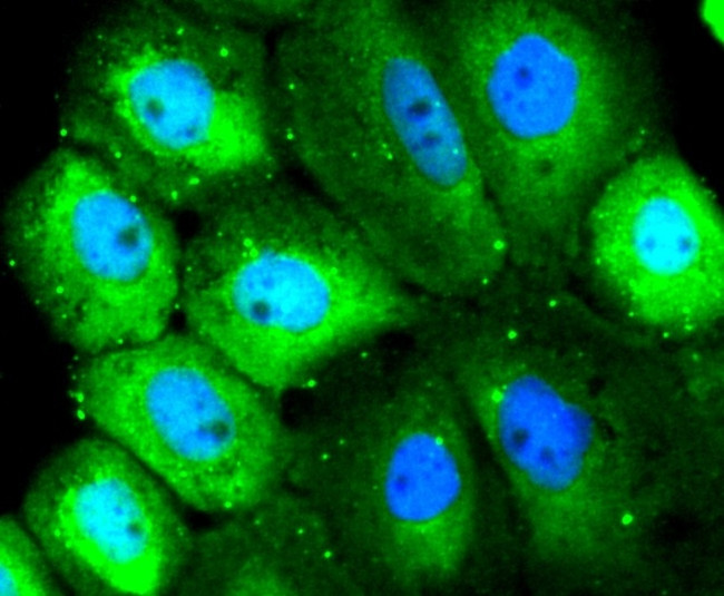 SRC Antibody in Immunocytochemistry (ICC/IF)