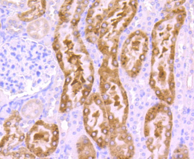 SRC Antibody in Immunohistochemistry (Paraffin) (IHC (P))