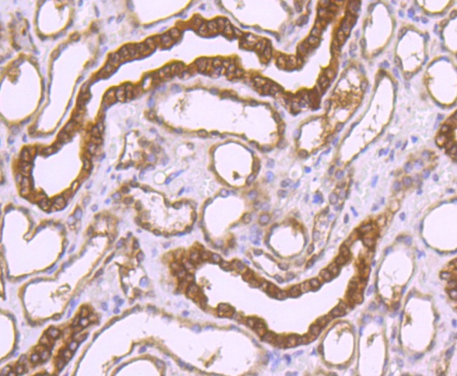 PRDX1 Antibody in Immunohistochemistry (Paraffin) (IHC (P))