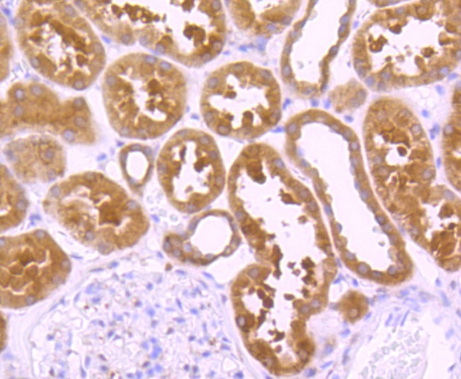 PRDX1 Antibody in Immunohistochemistry (Paraffin) (IHC (P))