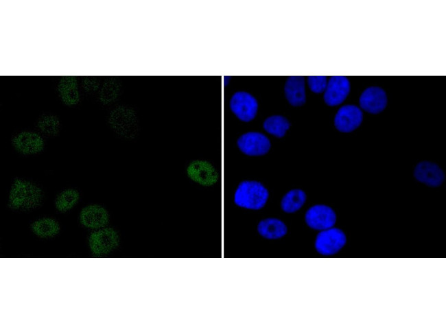 Progesterone Receptor Antibody in Immunocytochemistry (ICC/IF)