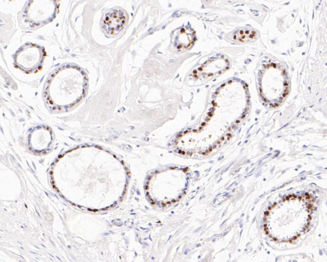 Progesterone Receptor Antibody in Immunohistochemistry (Paraffin) (IHC (P))