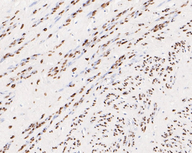 Progesterone Receptor Antibody in Immunohistochemistry (Paraffin) (IHC (P))