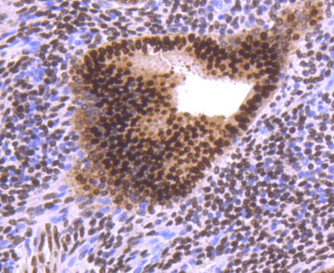 Progesterone Receptor Antibody in Immunohistochemistry (Paraffin) (IHC (P))