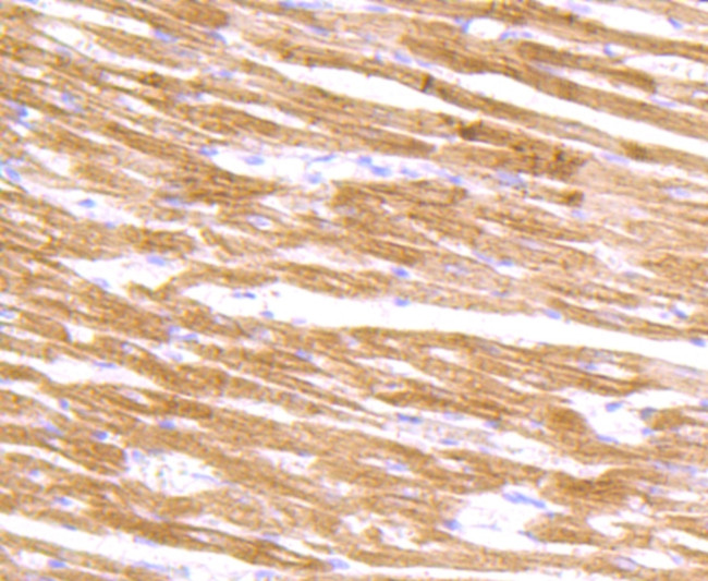 alpha Actinin 2 Antibody in Immunohistochemistry (Paraffin) (IHC (P))