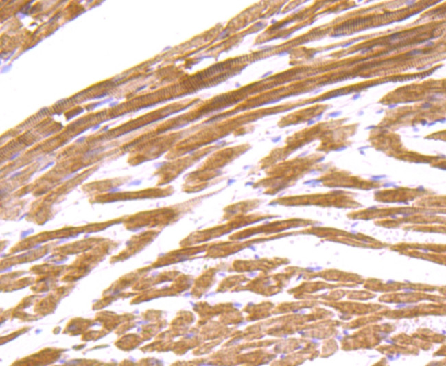 alpha Actinin 2 Antibody in Immunohistochemistry (Paraffin) (IHC (P))